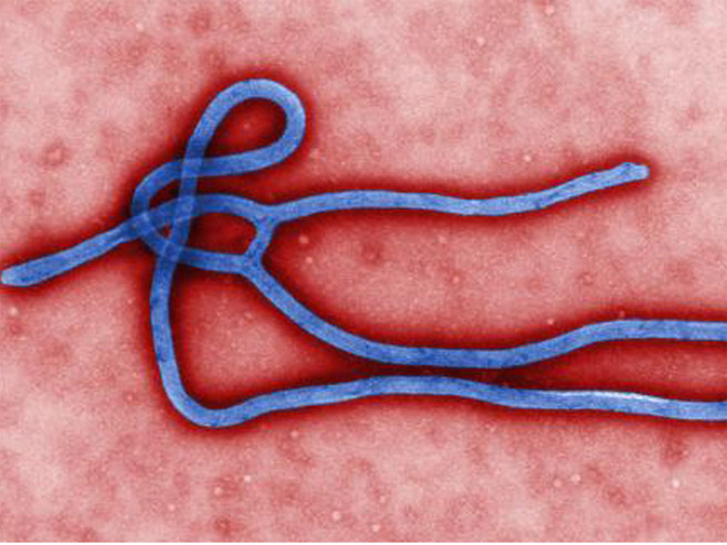 Virus ebole - Foto: Beta/AP