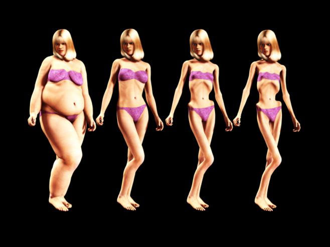 Anoreksija - Foto: ilustracija