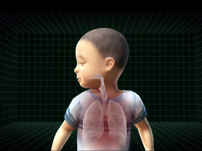 3D implant spasao život dječacima - Foto: Screenshot/YouTube