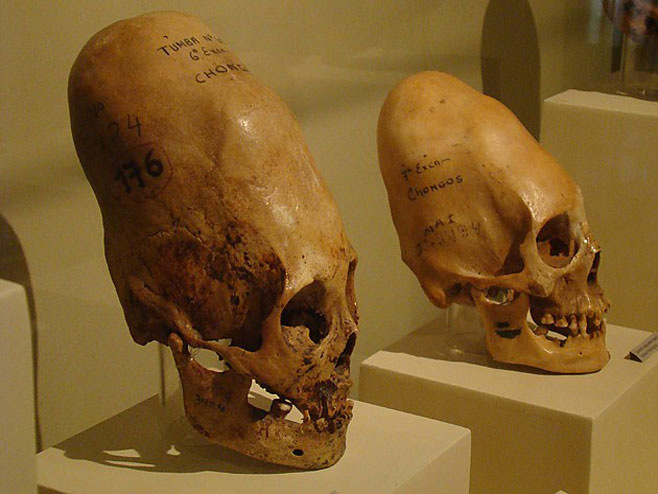Lobanje "vanzemaljaca?" pronađene u starim grobnicama u Peruu
(Foto:cont.ws) - 