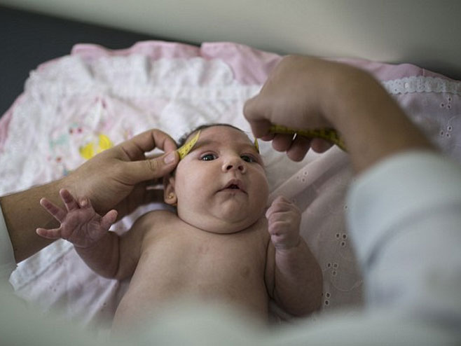 Zika virus uzrok mikrocefalije - Foto: AP