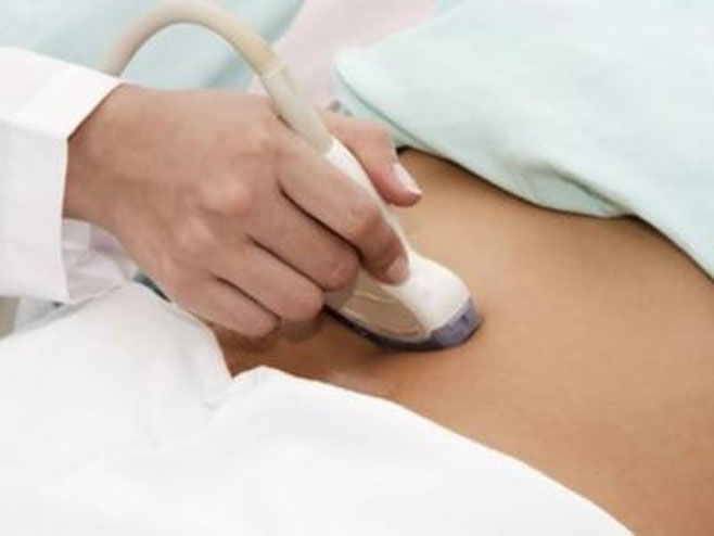 Ultrazvučni pregled - Foto: ilustracija