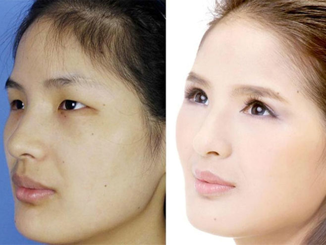 Kineskinje mijenjaju izgled očiju (foto: blic.rs) - 
